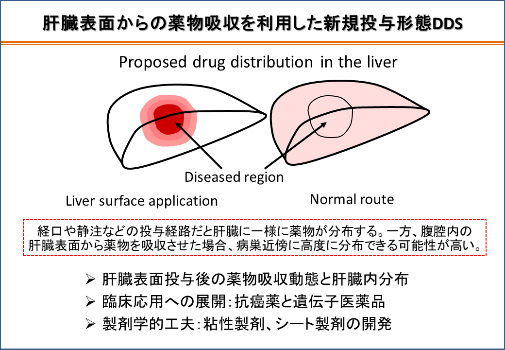 新規投与形態DDS